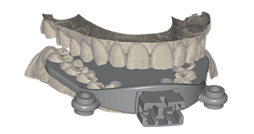 exocad Jaw Motion Import (Flex Initial Purchase)